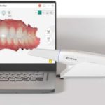 Le flux numérique dentaire : les erreurs fréquentes lors de la transition