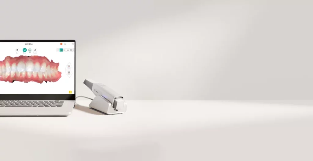 scanner intra-oral